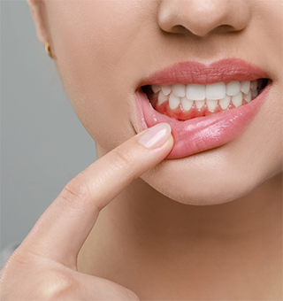 歯ぐきが腫れている・出血する