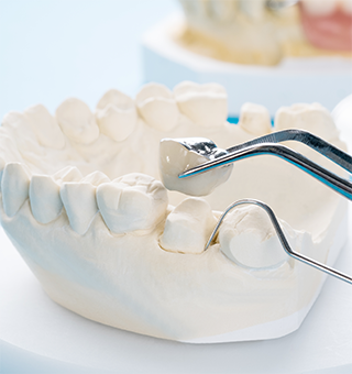 詰め物・被せ物が取れた・割れた