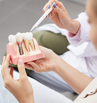 インプラントについて知りたい